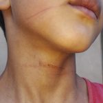Garoto de 8 anos é atingido por linha com cerol, cai da bicicleta e quase é atropelado em Água Clara (MS)